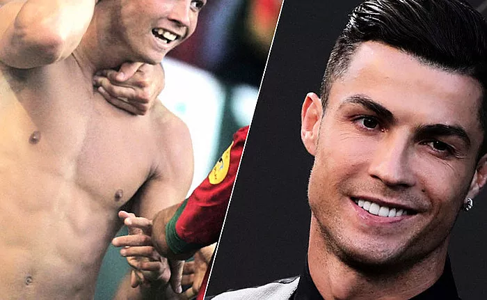 There is no limit to perfection. 6 famous football players who did plastic surgery