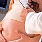 Hva er farene ved en tredje graviditet etter to keisersnitt?