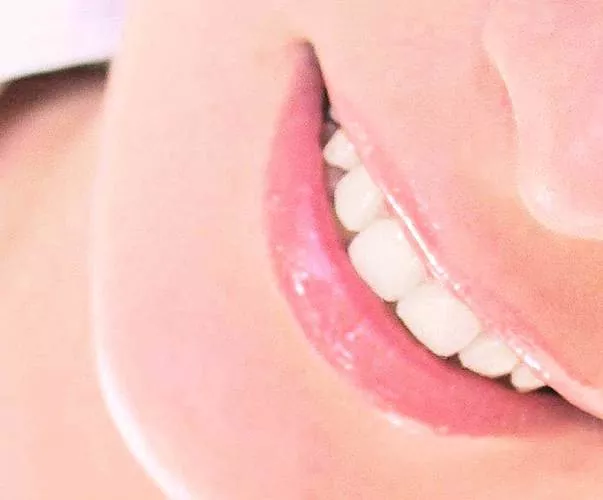 Dişler düzgün ve çok iyi değil: çarpık dişler neden rüya görür?