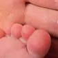 چرا کودک بین انگشتان و دستانش پوستی دارد؟ علل و راههای مقابله با این بیماری
