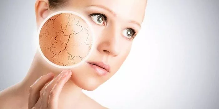 Rougeur et desquamation de la peau du visage: causes et traitement