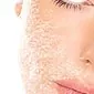 Redness and peeling of the skin on the face: causes and treatment