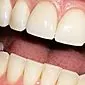 Kalcium för tänder: hur fyller man på reserven för elementet i kroppen?