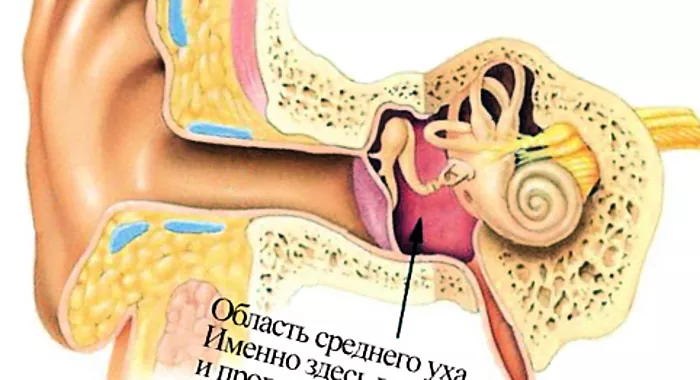 Peradangan tabung pendengaran: penyebab, gejala, pengobatan