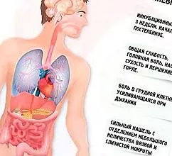 Mycoplasma pneumonia sa mga bata: simtomas, panghiling, pagtambal