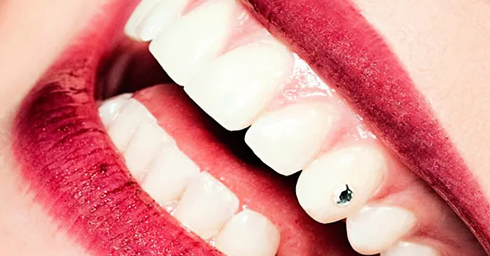 Berlian imitasi di gigi