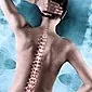Perpindahan vertebra: sebab, gejala, tanda