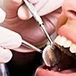آیا درمان دندان با شیردهی امکان پذیر است؟