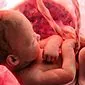مثانه جنین: چیست ، مشکلات احتمالی ، دستکاری های پزشکی