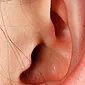 Kerak di belakang telinga orang dewasa - bagaimana dan bagaimana merawat scrofula, eksim atau alahan?