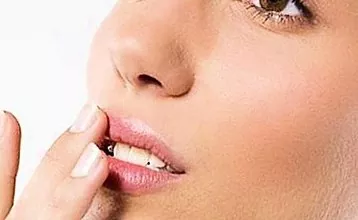 Ispucale usne: uzroci i liječenje