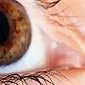 Apa itu sindrom mata kering?