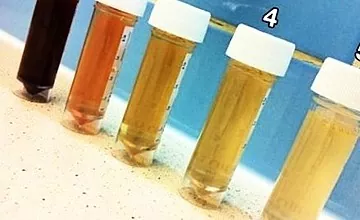 Air kencing oren: adakah warna ini normal atau patologi?