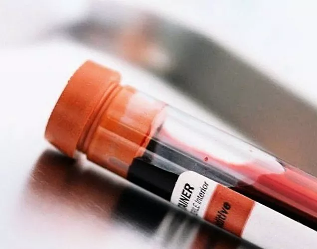 Kasvaja markerid: mida näitab vereanalüüs?