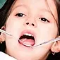 Cara mencabut gigi anak tanpa rasa sakit