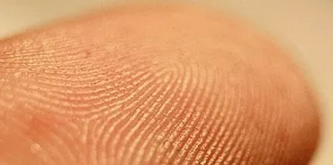 Fingermönster: när visas de och vad är de?