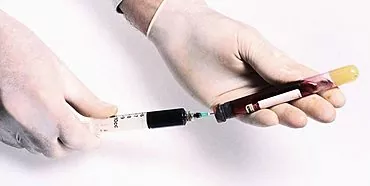 Test glukoze u krvi tijekom trudnoće