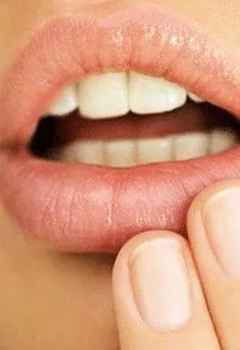 Doenças da parte mais sedutora do rosto: lábios problemáticos
