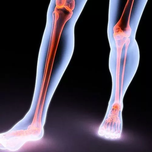 Fibroidid jalgadel: tüübid, sümptomid, ravi