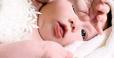 Τι σημαίνει η λευκή πλάκα στη γλώσσα του μωρού;