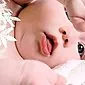 Apa arti plak putih di lidah bayi?