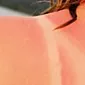 Koža na soncu: kako jo zaščititi pred žgočimi žarki?