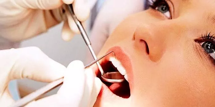 Retak dan lapisan putih di lidah - penyebab, gejala, pengobatan