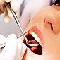 Retak dan lapisan putih di lidah - penyebab, gejala, pengobatan