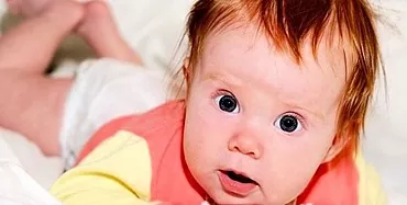 Kapan bayi yang baru lahir didiagnosis dengan gejala Graefe? Semua Tentang Setting Sun Syndrome