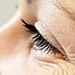 Wrinkles around the eyes