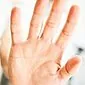 Palą się dłonie - mistycyzm czy choroba?