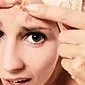 Jerawat dalaman pada wajah: sebab dan kaedah rawatan