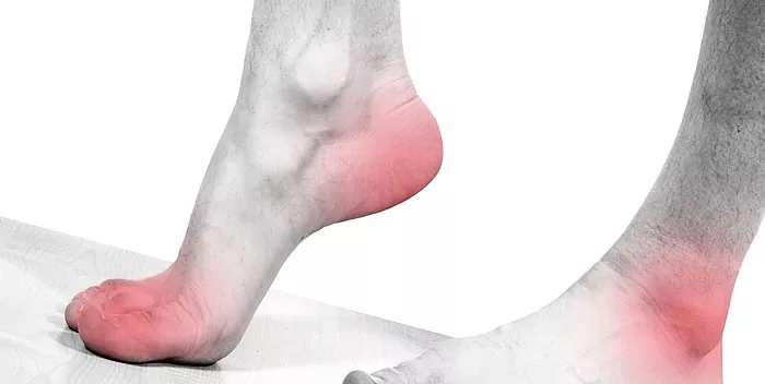 Sakit kaki saat berjalan: penyebab dan pengobatan
