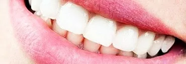Punca plak hitam pada gigi dan cara menghilangkannya