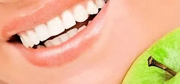 کاشت دندان - انتخاب گزینه مناسب