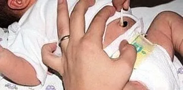 טיפול באזור הטבור של התינוק
