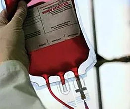 چرا میزان لخته شدن خون در دوران بارداری بسیار مهم است؟