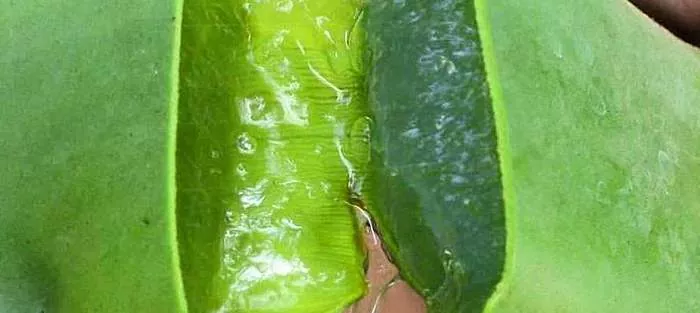 Aloe Vera - propriedades benéficas de uma planta para perda de peso
