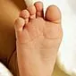 علل و درمان مدفوع کف دار در نوزاد تازه متولد شده