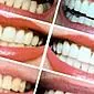 מדוע השיניים מצהיבות ואיך להימנע מסכום זה?