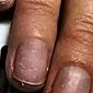 Odbudowa paznokci po przedłużeniu