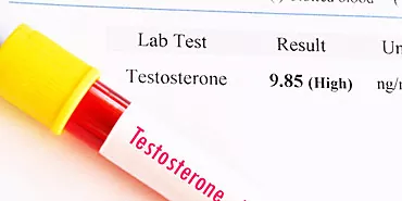 Toda la verdad sobre la testosterona. La hormona que convierte a un hombre en hombre