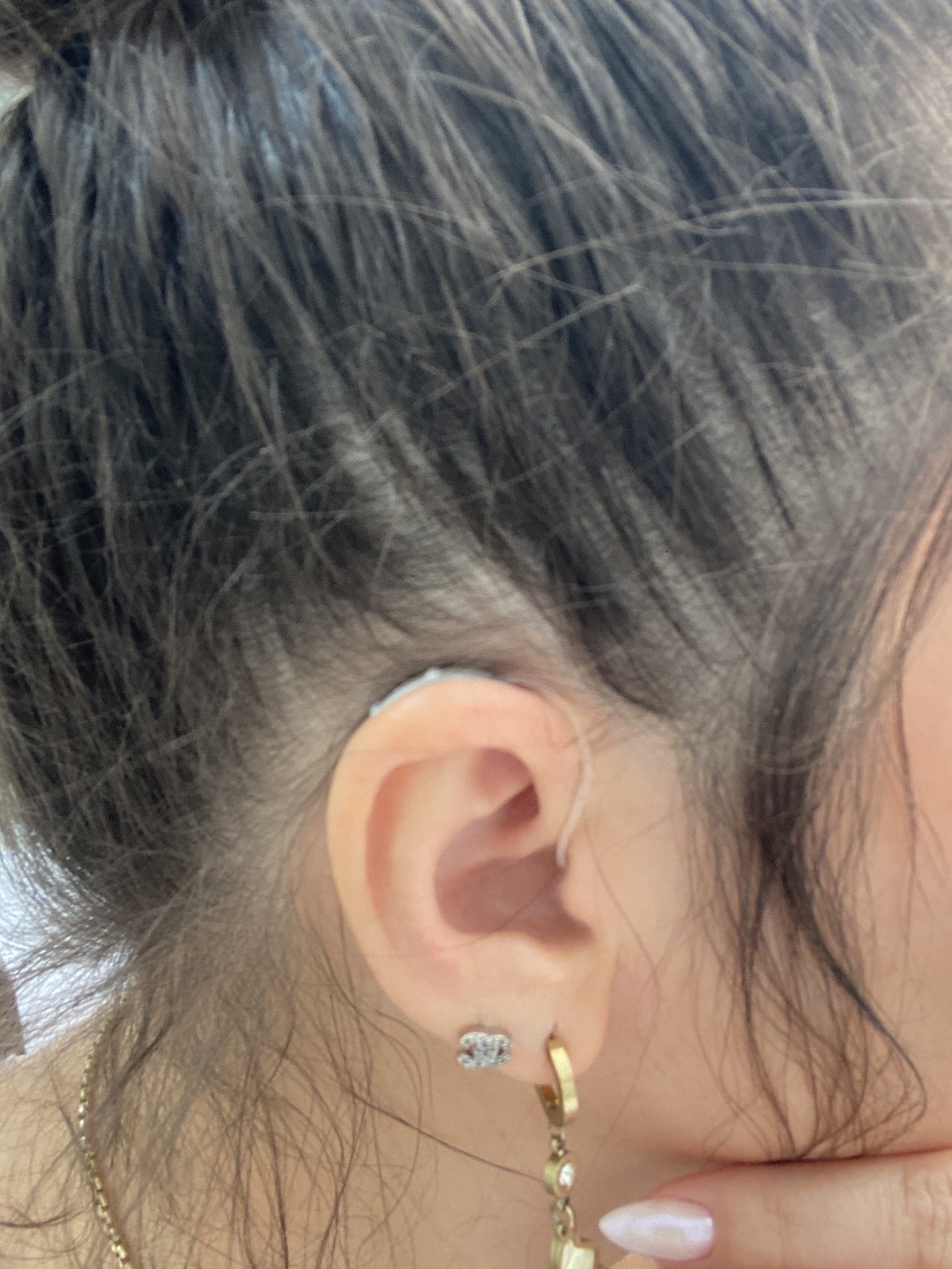 Слуховые аппараты - изображение 3