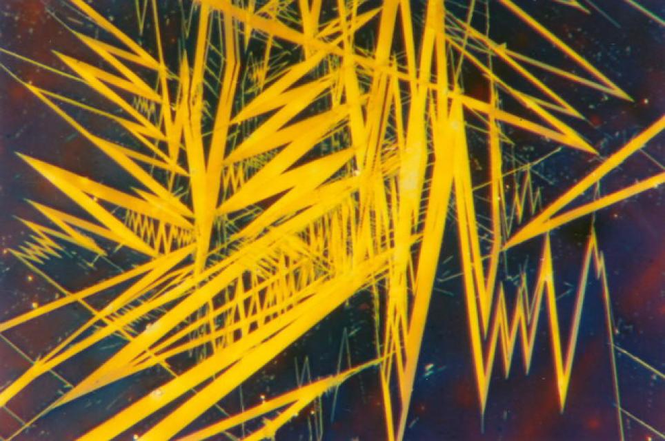 Hellfeld, 500-fache Vergrößerung Hellfeld, 500-fache Vergrößerung