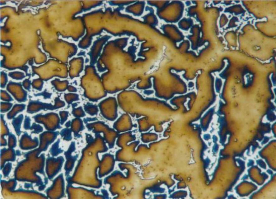 Hellfeld, 200-fache Vergrößerung Hellfeld, 200-fache Vergrößerung