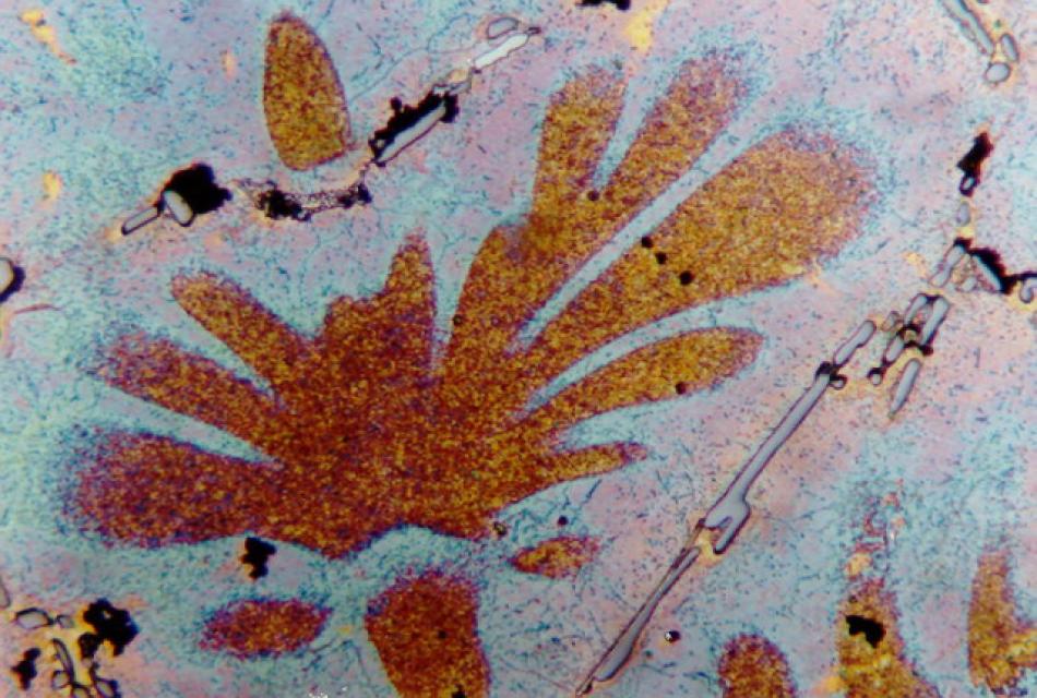 Hellfeld, 100-fache Vergrößerung Hellfeld, 100-fache Vergrößerung