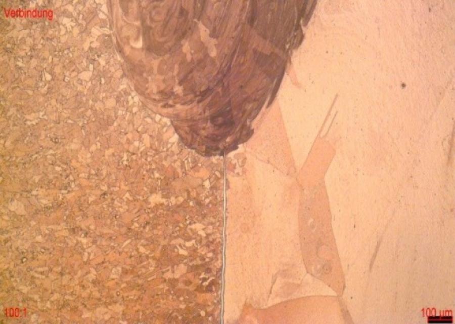 Hellfeld, 100-fache Vergrößerung Hellfeld, 100-fache Vergrößerung