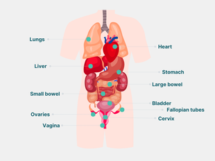 Diagram of organs including ovaries