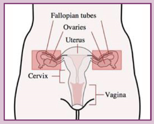 RRSO  The current operation which is standard of care on the NHS (removal of both tubes and ovaries at the same time).