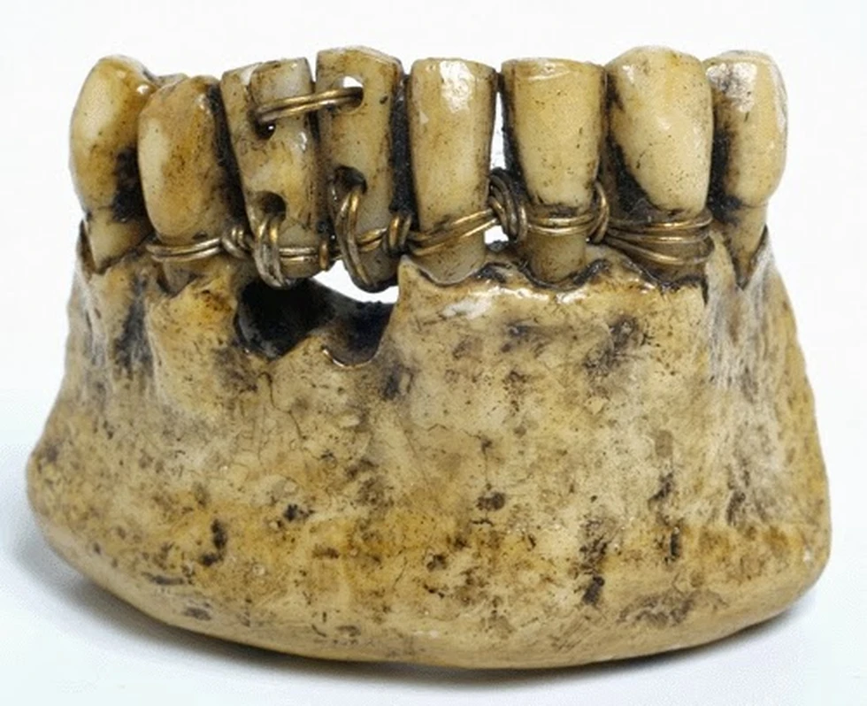 Origen de las dentaduras postizas...